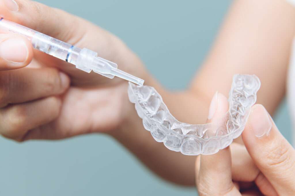 Expert Teeth Whitening in St Helens