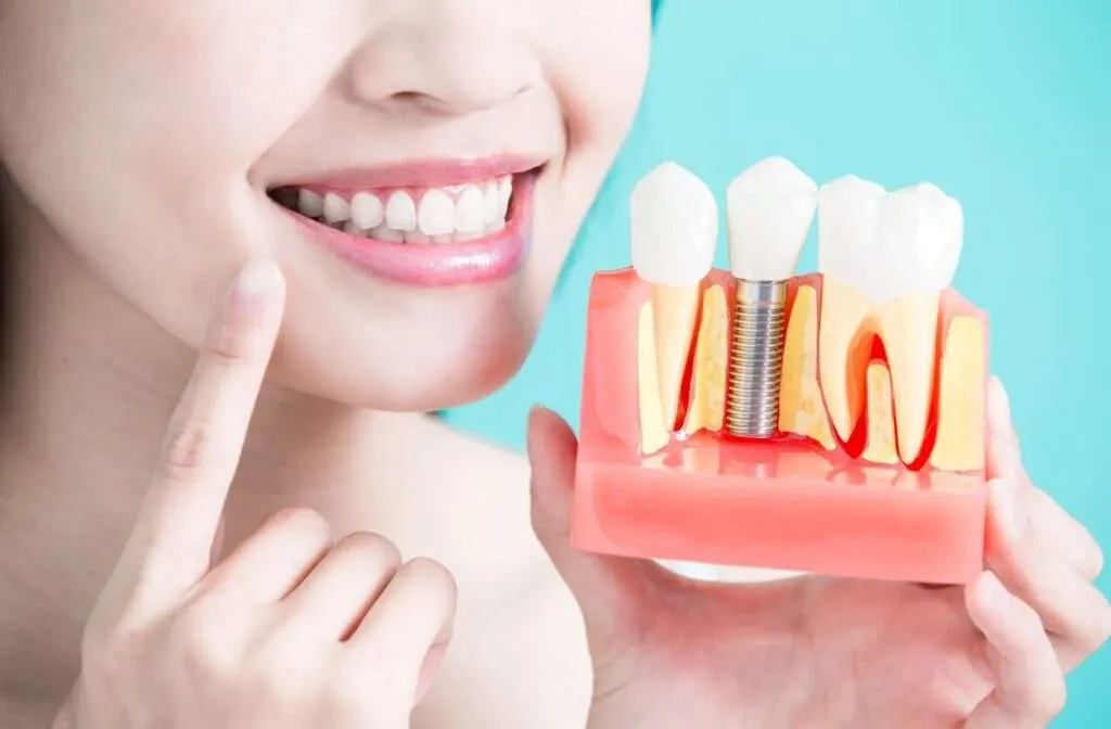 How to Choose the Right Dental Monthly Plan for Your Needs and Budget