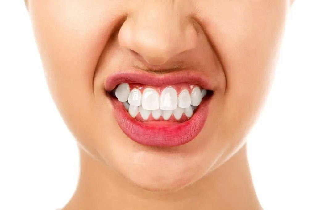 How to Care for Your Teeth After Composite Bonding: Tips and Best Practices for Long-Term Success