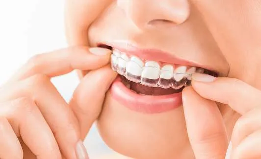 How to Care for Your Teeth During Invisalign Treatment: Tips and Best Practices
