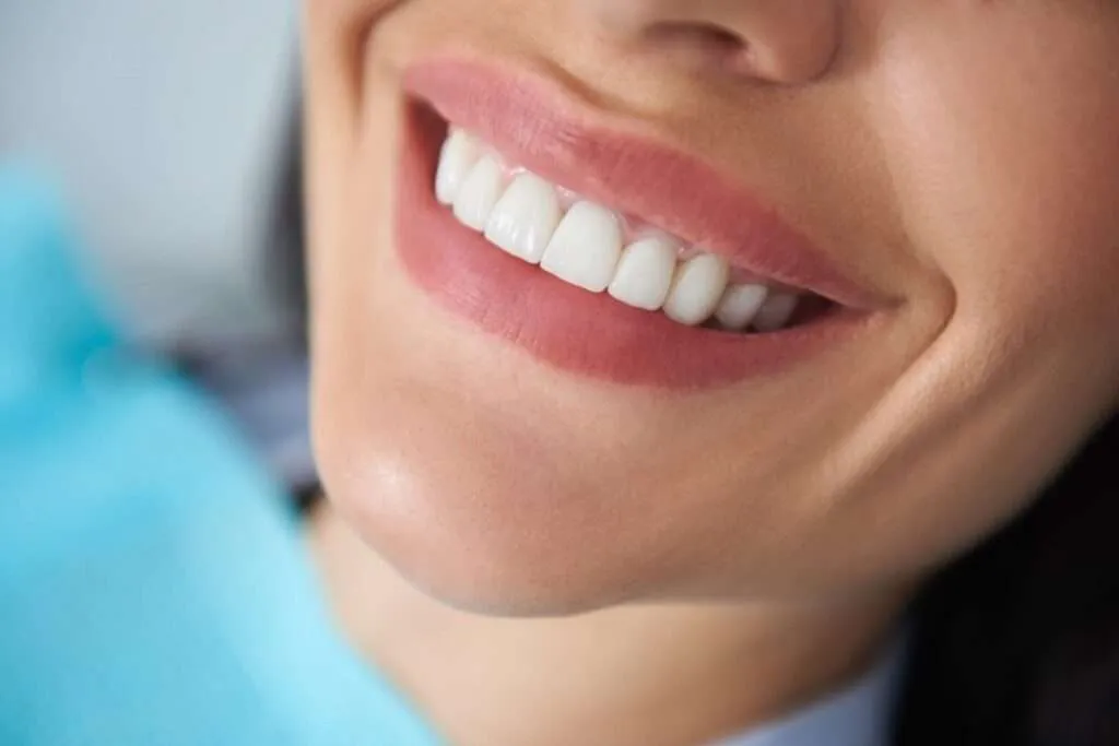 Composite Bonding