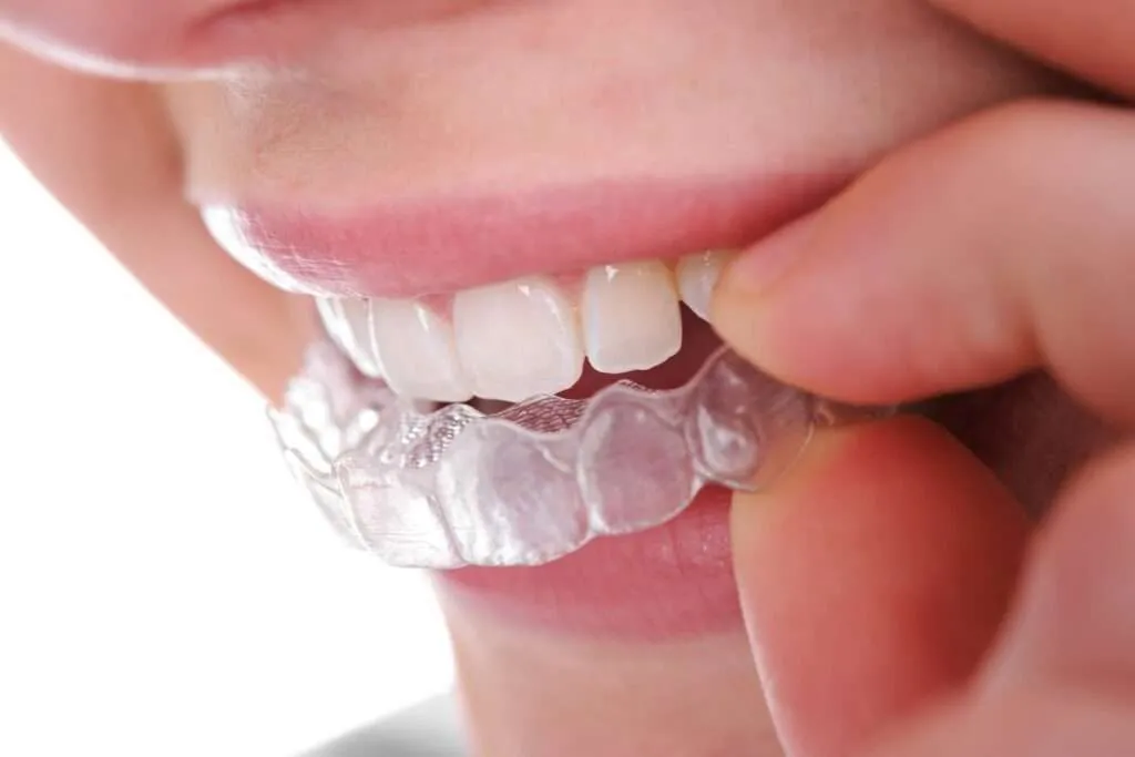Invisalign Cost