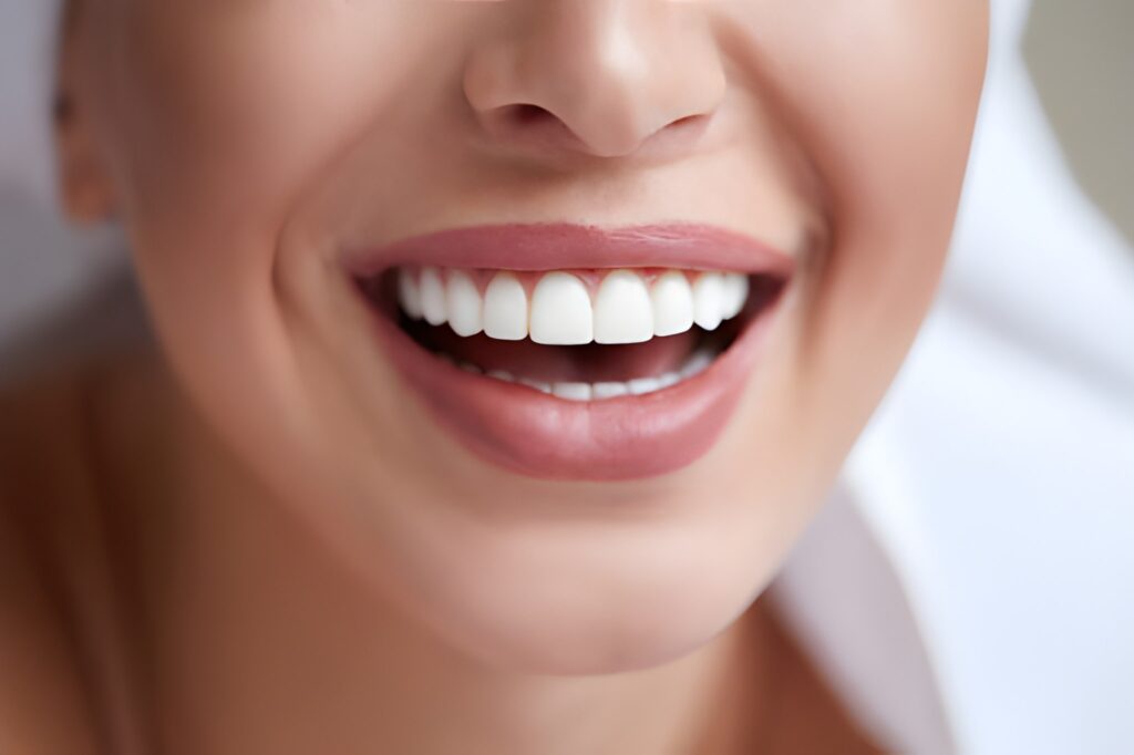 teeth whitening in St Helens
