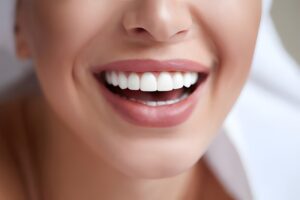 teeth whitening in St Helens